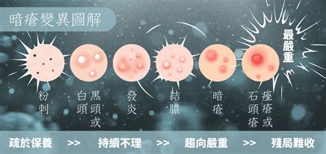 外陰石頭瘡|【石頭瘡】會自己好？了解5大成因+治療及解決方法